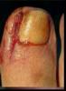 post-850366-0-97834300-1358706605_thumb.jpg
