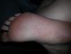 post-634579-1255754_thumb.jpg