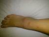 post-42-0-23557300-1360144025_thumb.jpg