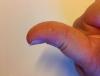 post-42-1704403_thumb.jpg