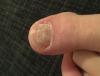 post-627507-433744_thumb.jpg