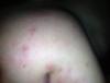 post-42-0-81657100-1365355770_thumb.jpg
