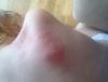 post-42-379233_thumb.jpg