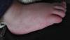 post-42-0-87875900-1429894752_thumb.jpg