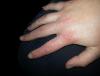 post-42-1960201_thumb.jpg