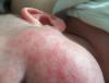 post-42-685035_thumb.jpg