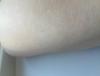 post-42-738100_thumb.jpeg