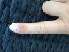 post-706971-1306251_thumb.jpg