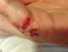 post-42-1224558_thumb.jpeg