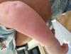 post-42-1493257_thumb.jpeg