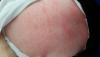 post-42-1755095_thumb.jpg