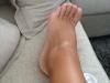 post-42-0-73136200-1404806014_thumb.jpg