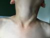 post-42-203104_thumb.jpg