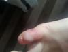 post-42-41524_thumb.jpg