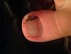 post-42-743127_thumb.jpg