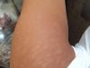 post-42-145695_thumb.jpg