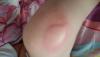 post-42-621385_thumb.jpg