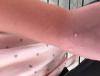 post-861363-1208281_thumb.jpeg