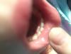 post-42-175030_thumb.jpg