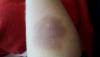 post-42-1533894_thumb.jpg