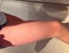 post-42-1833295_thumb.jpeg