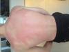 post-42-883472_thumb.jpeg