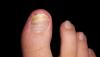 post-42-291753_thumb.jpg