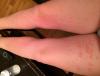 post-631587-481859_thumb.jpg