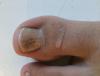 post-42-3924_thumb.jpeg