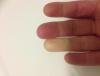 post-42-1174587_thumb.jpg