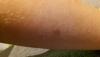 post-42-0-40730100-1478543511_thumb.jpg