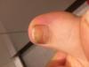 post-42-1038264_thumb.jpeg