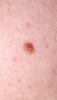 post-42-530092_thumb.png